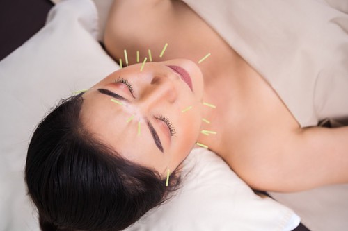 What is Acupuncture?