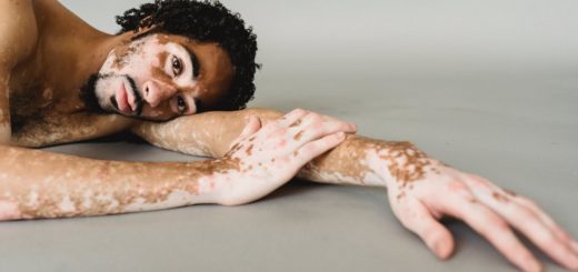 black man with vitiligo lying on floor of studio