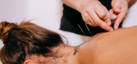 acupuncture healing benefits