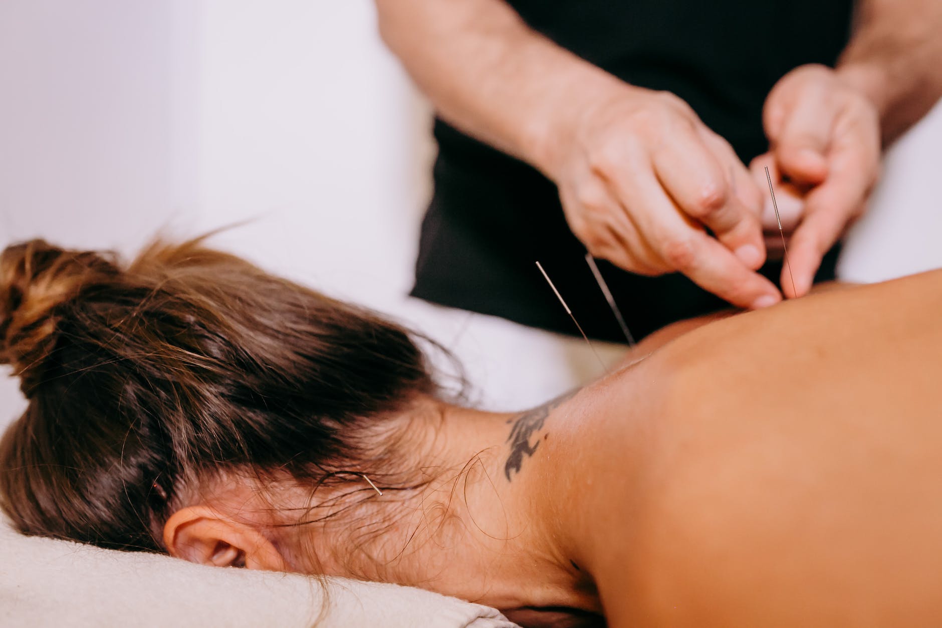 acupuncture healing benefits