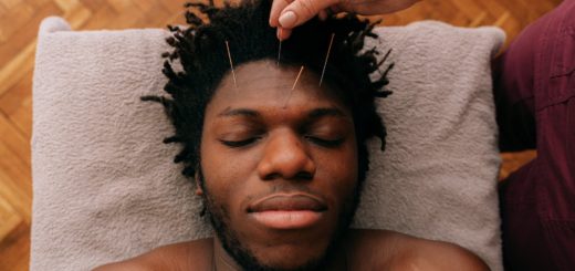 acupuncture healing benefits